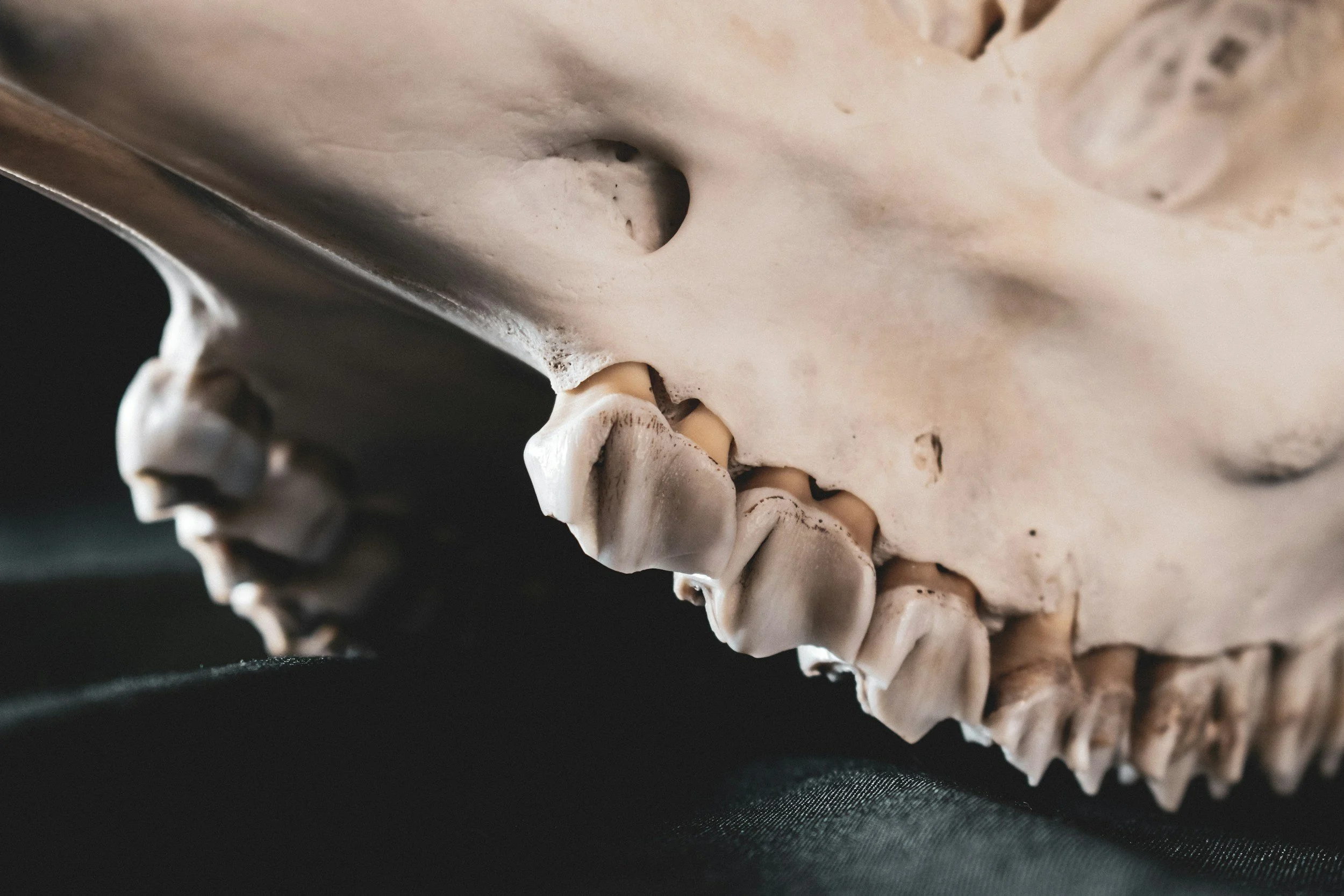 Where Can I Sell Gold Dental Crowns and Fillings?